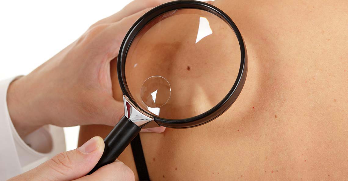 skin checks Inkerman Medical Group